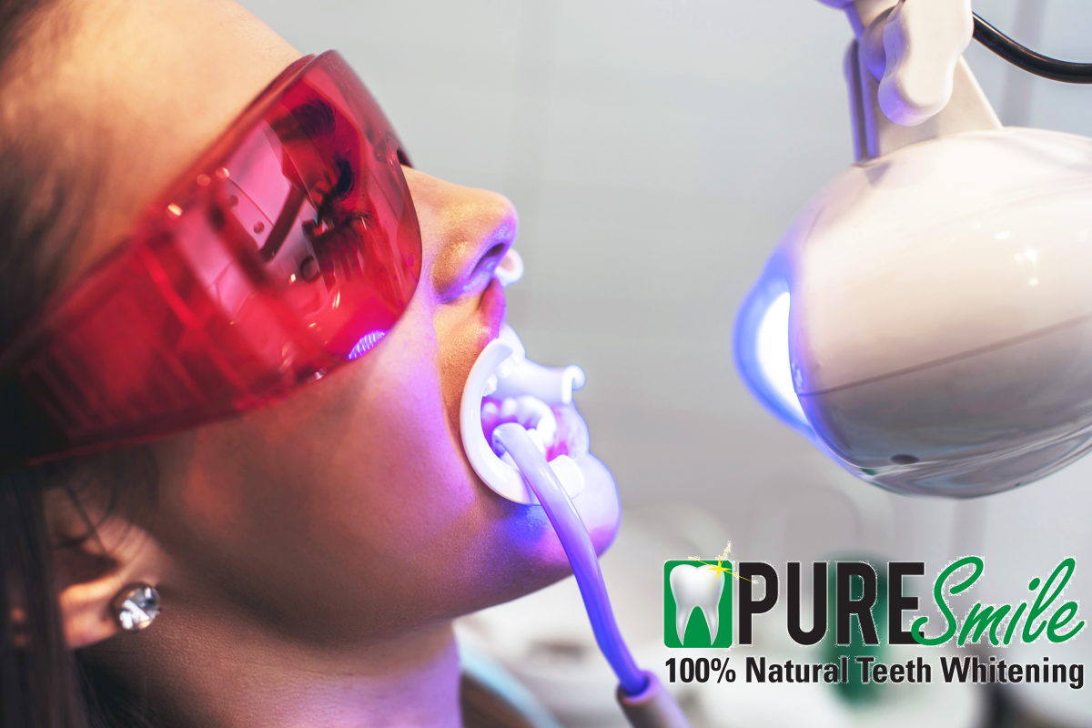 teeth whitening kit